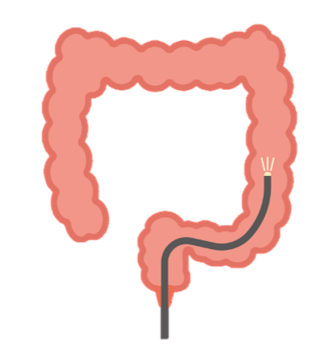 大腸カメラ検査